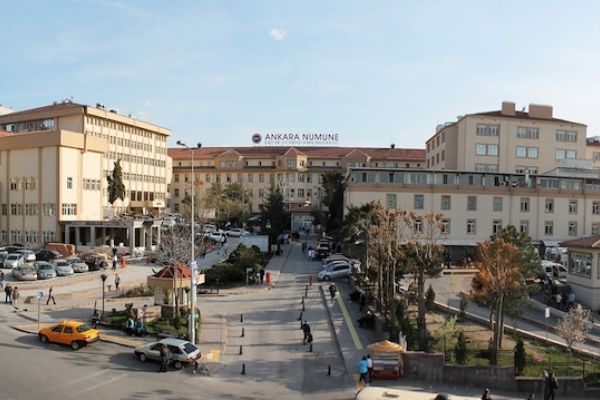 ankara numune